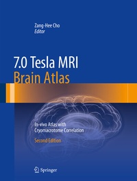 Abbildung von: 7.0 Tesla MRI Brain Atlas - Springer