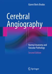 Abbildung von: Cerebral Angiography - Springer