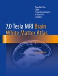 Abbildung von: 7.0 Tesla MRI Brain White Matter Atlas - Springer