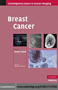 Enlarge image Cover: Breast Cancer - Cambridge University Press