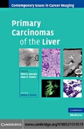 Cover: Primary Carcinomas of the Liver - Cambridge University Press