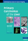 Cover: Primary Carcinomas of the Liver - Cambridge University Press