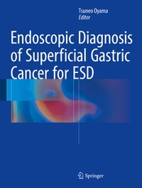 Abbildung von: Endoscopic Diagnosis of Superficial Gastric Cancer for ESD - Springer