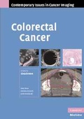 Cover: Colorectal Cancer - Cambridge University Press