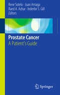 Cover: Prostate Cancer - Springer