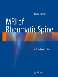 Abbildung von: MRI of Rheumatic Spine - Springer
