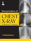 Cover: Interpretation of Chest X-Ray - Jaypee Brothers Medical Publishers
