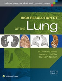Enlarge image Cover: High-Resolution CT of the Lung - Lippincott Williams and Wilkins