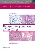 Cover: Biopsy Interpretation of the Liver - Lippincott Williams and Wilkins
