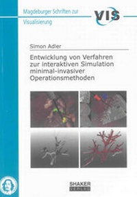 Enlarge image Cover: Entwicklung von Verfahren zur interaktiven Simulation minimal-invasiver Operationsmethoden - Shaker
