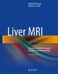 Cover: Liver MRI - Springer