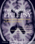 Cover: The Causes of Epilepsy - Cambridge University Press