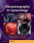 Cover: Ultrasonography in Gynecology - Cambridge University Press
