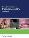 Cover: Fundamentals of Implant Dentistry - Wiley-Blackwell