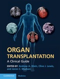 Cover: Organ Transplantation - Cambridge University Press