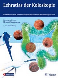 Abbildung von: Lehratlas der Koloskopie - Thieme