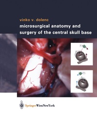 Bild: Microsurgical Anatomy and Surgery of the Central Skull Base - Springer