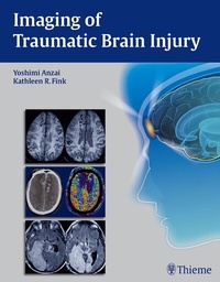 Enlarge image Cover: Imaging of Traumatic Brain Injury - Thieme Publishers