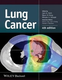 Abbildung von: Lung Cancer - Wiley-Blackwell