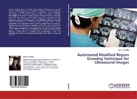Abbildung von: Automated Modified Region Growing Technique for Ultrasound Images - LAP Lambert Academic Publishing