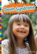 Cover: Down Syndrome - Amicus High Interest