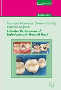 Cover: Adhesive Restoration of Endodontically Treated Teeth - Quintessence Publishing Co. Ltd.