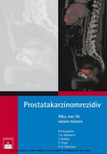 Cover: Prostatakarzinomrezidiv - Zuckschwerdt