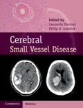 Abbildung von: Cerebral Small Vessel Disease - Cambridge University Press
