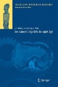 Cover: Les Cancers Digestifs Du Sujet A[ga(c) - Springer