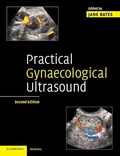 Cover: Practical Gynaecological Ultrasound - Cambridge University Press