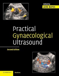 Enlarge image Cover: Practical Gynaecological Ultrasound - Cambridge University Press