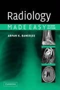 Cover: Radiology Made Easy - Cambridge University Press