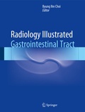 Cover: Radiology Illustrated: Gastrointestinal Tract - Springer