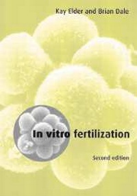 Enlarge image Cover: In Vitro Fertilization - Cambridge University Press