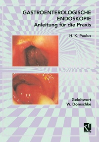 Abbildung von: Gastroenterologische Endoskopie Anleitung für die Praxis - Vieweg+Teubner Verlag