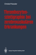 Abbildung von: Thrombozytenszintigraphie bei zerebrovaskulären Erkrankungen - Springer