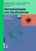 Cover: Dermatoskopie von Hauttumoren - Steinkopff