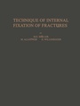 Cover: Technique of Internal Fixation of Fractures - Springer