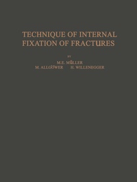 Enlarge image Cover: Technique of Internal Fixation of Fractures - Springer