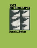 Cover: Knee Arthrography - Chapman and Hall