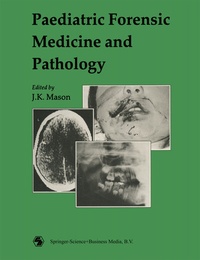 Abbildung von: Paediatric Forensic Medicine and Pathology - Hodder Arnold