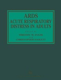 Cover: ARDS Acute Respiratory Distress in Adults - Springer