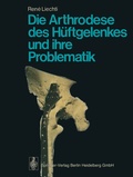 Cover: Die Arthrodese des H&uuml;ftgelenkes und ihre Problematik - Springer