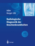Cover: Radiologische Diagnostik der Knochenkrankheiten - Springer