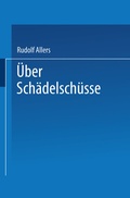 Cover: &Uuml;ber Sch&auml;delsch&uuml;sse - Springer