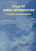 Cover: Atlas of Human Reproduction - Springer
