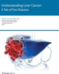 Enlarge image Cover: Understanding Liver Cancer - Springer Healthcare