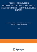 Cover: EkZem &middot; Dermatitis Pruritus &middot; Prurigo &middot; Strophulus Neurodermitis&middot;Seborrhoisches EkZem - Springer