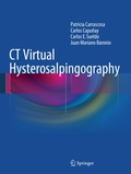 Cover: CT Virtual Hysterosalpingography - Springer