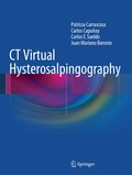 Cover: CT Virtual Hysterosalpingography - Springer